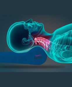 Alternative view of Tynor Contoured Cervical Pillow: Relief for Neck Pain